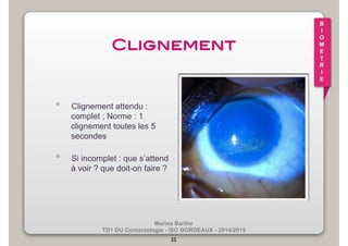 Marina Barthe 
TD1 DU Contactologie - ISO BORDEAUX - 2014/2015 
35 
B 
I 
O 
M 
E 
T 
R 
I 
E 
Clignement! 
• Clignement attendu : 
complet ; Norme : 1 
clignement toutes les 5 
secondes 
• Si incomplet : que s’attend 
à voir ? que doit-on faire ? 
 