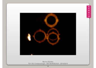 Marina Barthe 
TD1 DU Contactologie - ISO BORDEAUX - 2014/2015 
4 
K 
E 
R 
A 
T 
O 
 