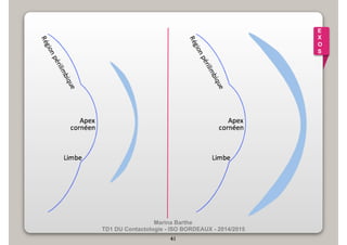 Marina Barthe 
TD1 DU Contactologie - ISO BORDEAUX - 2014/2015 
41 
E 
X 
O 
S 
 