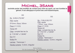 Michel, 35ans! 
souhaite porter des lentilles de contact pour faire du sport, car ses lunettes le 
gênent. Il est allergique et prend des anti-histaminiques. 
Rx: -8,00(-0,75)180° 
PSC rapide 
∅12mm; ∅pup: 3/5mm 
Paup (+1;+0,5) 
Tonus std 
Clign. complet ttes les 3s 
K: 7,70/180° x 7,60/90° 
Exc 0,5 
Knibut 5s 
Larmes : Tearscope 1 
Hauteur prisme : 0,3mm, irrégulier 
Marina Barthe 
OD 
TD1 DU Contactologie - ISO BORDEAUX - 2014/2015 
45 
E 
X 
O 
S 
OG 
Rx: -7,00(-0,50)170° 
PSC rapide 
∅12mm; ∅pup: 3/5mm 
Paup (+1;+0,5) 
Tonus std 
Clign. complet ttes les 3s 
K: 7,70/170° x 7,60/80° 
Exc 0,5 
Knibut 5s 
Larmes : Tearscope 1 
Hauteur prisme : 0,3mm, irrégulier 
 