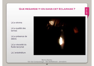 Que regarde-t-on dans cet éclairage ?! 
Marina Barthe 
TD1 DU Contactologie - ISO BORDEAUX - 2014/2015 
❏ Le stroma 
❏ La qualité des 
larmes 
❏ La présence de 
débris 
❏ La viscosité du 
fluide lacrymal 
❏ L’endothélium 
49 
Q 
C 
M 
 