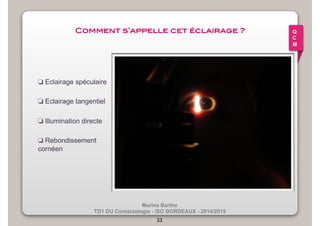 Comment s’appelle cet éclairage ?! 
Marina Barthe 
❏ Eclairage spéculaire 
❏ Eclairage tangentiel 
❏ Illumination directe 
❏ Rebondissement 
cornéen 
TD1 DU Contactologie - ISO BORDEAUX - 2014/2015 
53 
Q 
C 
M 
 