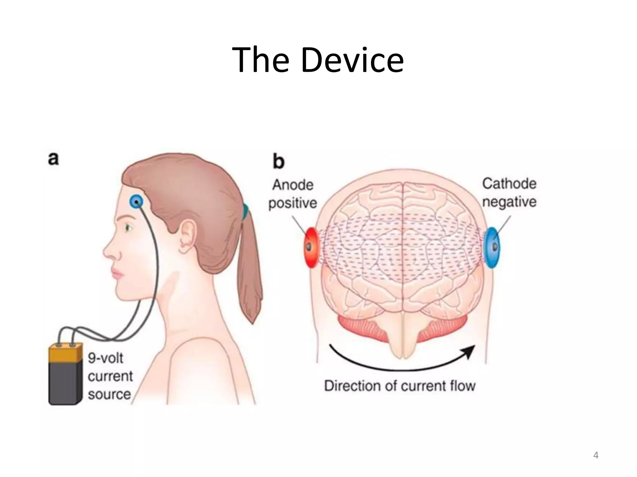 The Device
4
 