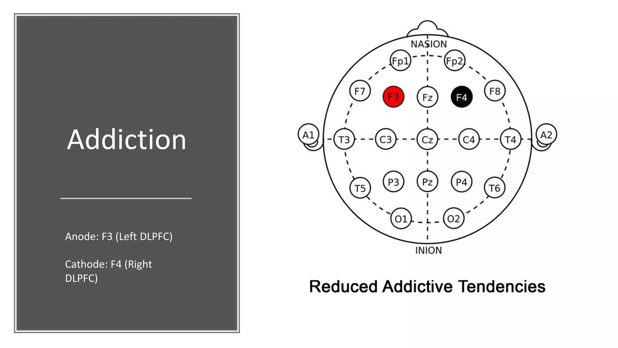 Addiction
Anode: F3 (Left DLPFC)
Cathode: F4 (Right
DLPFC)
 