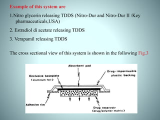 Example of this system are
1.Nitro glycerin releasing TDDS (Nitro-Dur and Nitro-Dur II /Key
pharmaceuticals,USA)
2. Estradiol di acetate releasing TDDS
3. Verapamil releasing TDDS
The cross sectional view of this system is shown in the following Fig.3
 