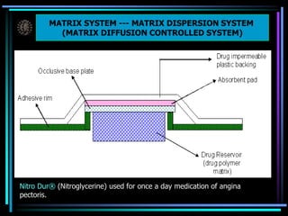 MATRIX SYSTEM --- MATRIX DISPERSION SYSTEM
(MATRIX DIFFUSION CONTROLLED SYSTEM)
MATRIX SYSTEM --- MATRIX DISPERSION SYSTEM
(MATRIX DIFFUSION CONTROLLED SYSTEM)
Nitro Dur® (Nitroglycerine) used for once a day medication of angina
pectoris.
 