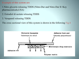 Example of this system are
1.Nitro glycerin releasing TDDS (Nitro-Dur and Nitro-Dur II /Key
pharmaceuticals,USA)
2. Estradiol di acetate releasing TDDS
3. Verapamil releasing TDDS
The cross sectional view of this system is shown in the following Fig.4
 
