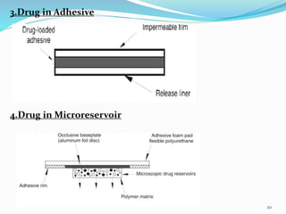 3.Drug in Adhesive
4.Drug in Microreservoir
20
 