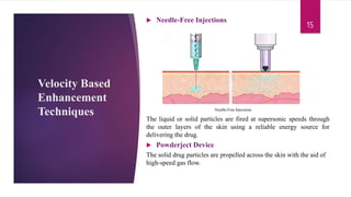 EVALUATION AND RECENT TECHNIQUES OF TRANSDERMAL DRUG DELIVERY SYSTEM”.pptx