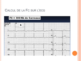 CALCUL DE

LA

FC

SUR L’ECG

 