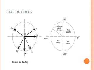 L’AXE

DU COEUR

Triaxe de bailey

 