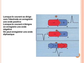 Lorsque le courant se dirige
vers l’électrode on enregistre
une onde positive
Lorsque le courant s’éloigne
on enregistre une onde
négative
On peut enregistrer une onde
diphasique

 