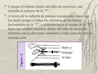    Coloque el émbolo dentro del tubo de inserción, casi
    tocando el extremo de la “T”.
   A través de la cubierta de plástico transparente, tome con
    los dedos pulgar e índice los extremos de los brazos
    horizontales de la “T”, y dóblelos hacia el cuerpo de la “T”
    hasta que queden retenidos dentro del tubo de inserción,
    mientras con la otra mano maniobra el tubo para facilitar la
    introducción.
 
