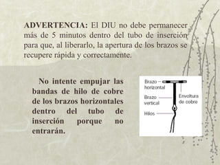 ADVERTENCIA: El DIU no debe permanecer
más de 5 minutos dentro del tubo de inserción
para que, al liberarlo, la apertura de los brazos se
recupere rápida y correctamente.


    No intente empujar las
  bandas de hilo de cobre
  de los brazos horizontales
  dentro del tubo de
  inserción    porque    no
  entrarán.
 