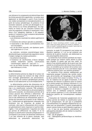 une sténose et la composante extrabronchique dont
les limites peuvent être appréciées. La tumeur peut
également se développer à partir d’une bronche
non visible normalement en tomodensitométrie, on
parle de tumeur périphérique. En présence d’une
anomalie nodulaire, qu’elle soit développée au ni-
veau central ou au niveau périphérique, les argu-
ments en faveur de son caractère tumoral sont,
outre les arguments cliniques et notamment l’exis-
tence d’un tabagisme supérieur à 20 paquets/
année et l’existence d’une croissance documentée
du nodule pulmonaire49,50
:
• une dimension maximale du nodule supérieure à
3 cm ;
• l’existence de contours spiculés ou polylobés ;
• l’association à des lésions surrénaliennes d’al-
lure secondaire ;
• en cas de lésion excavée, une épaisseur parié-
tale supérieure à 1,5 cm.
Au contraire, certaines caractéristiques tomo-
densitométriques constituent des arguments contre
l’origine maligne du nodule pulmonaire :
• la présence de graisse ;
• l’existence de calcifications d’allure bénigne
(nodule totalement calcifié, calcifications
concentriques, aspect en « pop corn ») ;
• en cas de lésion excavée, une épaisseur parié-
tale inférieure à 4 mm.
Bilan d’extension
La détermination précise du siège de la tumeur est
importante puisque les tumeurs de siège central
font envisager généralement une pneumonecto-
mie, alors que les tumeurs périphériques peuvent
relever d’une lobectomie ou d’une bilobectomie.12
La détermination précise des dimensions de la
tumeur est importante puisque cette donnée parti-
cipe à la classification tumorale TNM préopéra-
toire.35,88
En cas d’atélectasie ou de pneumopathie
obstructive associée, les dimensions précises de la
tumeur peuvent être difficiles à déterminer. On
peut s’aider du bombement paradoxal de la scis-
sure et des différences de rehaussement après in-
jection de contraste de la tumeur et de l’atélecta-
sie. L’atélectasie est généralement rehaussée très
fortement lors de l’injection de produit de
contraste, alors que le rehaussement de la tumeur
est généralement moins important et parfois hété-
rogène. C’est principalement l’argument de taille
qui permet de différencier les stades T1 et T2
puisque la classification tumorale préopératoire T1
correspond à une tumeur de dimension inférieure à
3 cm sans atteinte de la plèvre viscérale, sans
atélectasie ou pneumonie obstructive. Au
contraire, le stade T2 correspond à une tumeur de
diamètre supérieur à 3 cm ou qui présente une
atteinte de la plèvre viscérale, une atélectasie ou
une pneumopathie obstructive.
La recherche d’une atteinte pariétale est impor-
tante puisque les tumeurs ayant atteint la paroi
sont classées T3 quelle que soit leur taille. En
dehors d’une atteinte patente de la paroi avec lyse
costale ou envahissement des tissus mous extracos-
taux, on considère qu’un contact de la tumeur avec
la paroi mesurant plus de 3 cm a une bonne valeur
prédictive positive pour une atteinte pariétale.87
La recherche d’une atteinte médiastinale est
importante puisque l’atteinte des cavités cardia-
ques, de la trachée, de l’œsophage, d’une vertèbre
ou de la carène font classer la tumeur T4 (Fig. 23,
24). En l’absence de ces signes d’extension, il est
important de mesurer la distance entre la tumeur
et la carène puisqu’une distance inférieure à 2 cm
fait classer la tumeur T3. En dehors de signe patent
d’envahissement médiastinal, il est important de
mesurer la distance à laquelle la tumeur est en
contact avec le médiastin puisqu’on considère
qu’un contact supérieur à 3 cm a une bonne valeur
prédictive positive de l’envahissement médiasti-
nal.36,52
L’évaluation de l’extension ganglionnaire de la
tumeur permet de réaliser la classification tumo-
rale N préopératoire. On sait que la probabilité
d’envahissement d’un ganglion médiastinal est cor-
rélée avec ses dimensions. Il paraît raisonnable de
retenir comme limite un petit diamètre supérieur à
1 cm. Il faut de plus localiser précisément les
adénopathies décelées afin de réaliser la classifica-
tion préopératoire24
:
• N0 : pas de ganglion ;
• N1 : adénopathie péribronchique ou interbron-
chique ;
Figure 23 Cancer bronchique primitif. Il existe une volumi-
neuse masse sous-hilaire gauche qui envahit le médiastin, re-
foule et envahit l’oreillette gauche et envahit l’aorte dont les
contours sont complètement déformés.
198 L. Monnier-Cholley, L. Arrivé
 