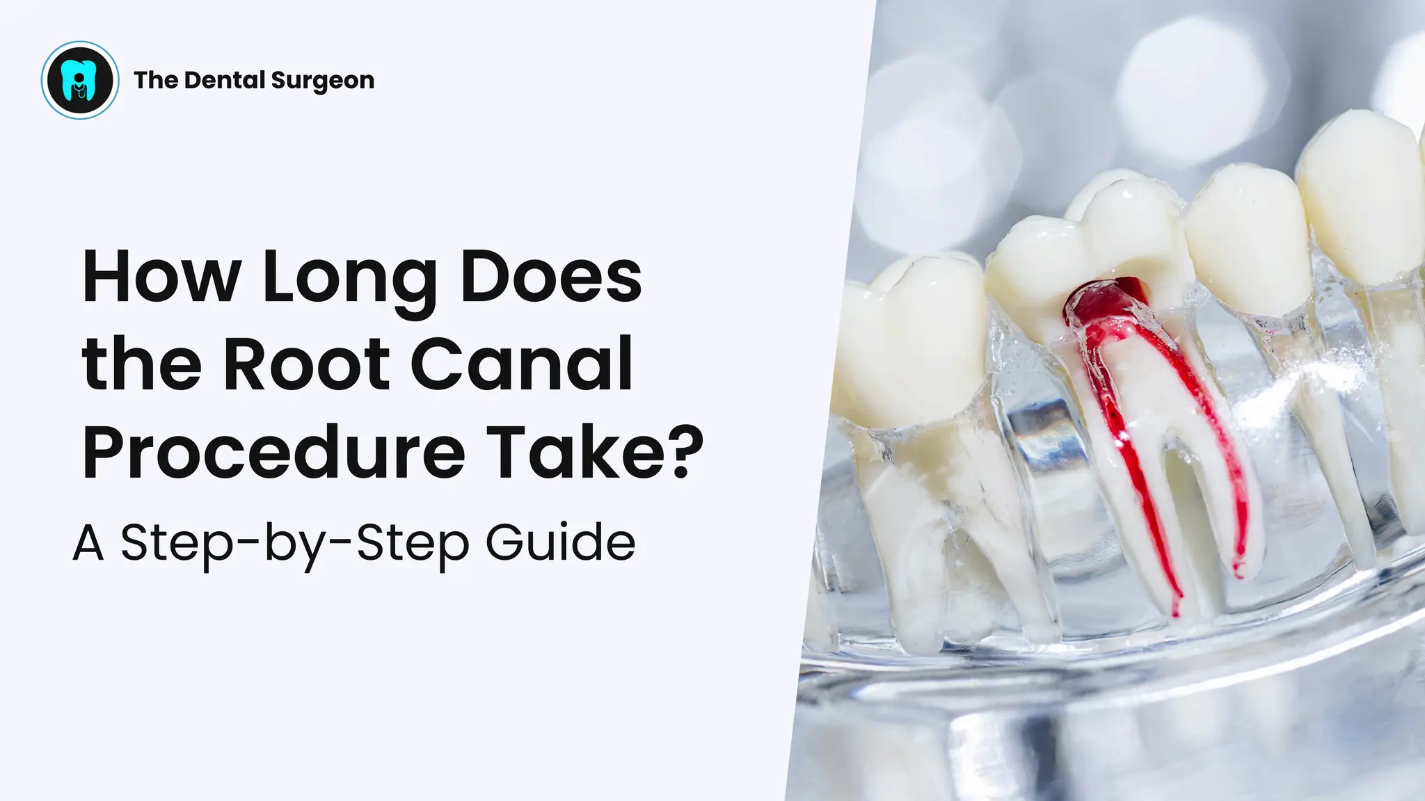 How Long Does a Root Canal Take? A Step-by-Step Patient Guide | PPT
