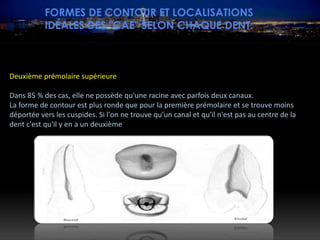 FORMES DE CONTOUR ET LOCALISATIONS
IDÉALES DES "CAE" SELON CHAQUE DENT:
Deuxième prémolaire supérieure
Dans 85 % des cas, elle ne possède qu'une racine avec parfois deux canaux.
La forme de contour est plus ronde que pour la première prémolaire et se trouve moins
déportée vers les cuspides. Si l'on ne trouve qu'un canal et qu'il n'est pas au centre de la
dent c'est qu'il y en a un deuxième
 