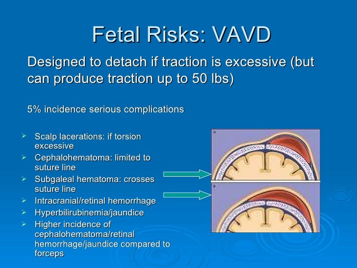 Teachingmoduleoperativevaginaldelivery