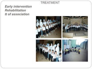 TREATMENT
Early intervention
Rehabilitation
tt of association
 