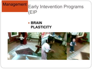 Early Intevention Programs
(EIP
 BRAIN
PLASTICITY
Management
 