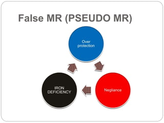 False MR (PSEUDO MR)
 