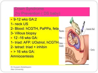Dr Hussein Abdeldayem
Alex University
Down Syndrome
2ry Prevention ( DS baby)
 9-12 wks GA:2
1- neck US
2- Blood: hCGTH, PaPPa, fetal RBC
3- Villous biopsy
 12 -16 wks GA:
1- triad: AFP. UOstriol, hCGTH
2- tetrad: triad + inhibin
 > 16 wks GA:
Amniocentesis
 