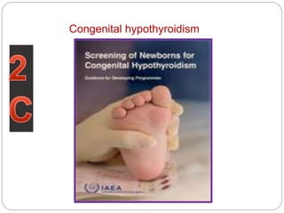Congenital hypothyroidism
 