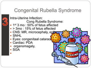 Dec 27,2003
Intra-Uterine Infection:
Cong Rubella Syndrome:
 1st 3 mo : 50% of fetus affected
 > 3mo : 15% of fetus affected
 CNS: MR, microcephaly, epilepsy
 SNHL
 Eyes: congenitaal cataract
 Cardiac: PDA
 organomagaly,
 SGA

Congenital Rubella Syndrome
 