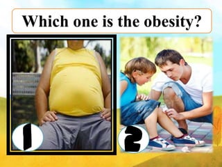 Which one is the obesity?

1

2

 