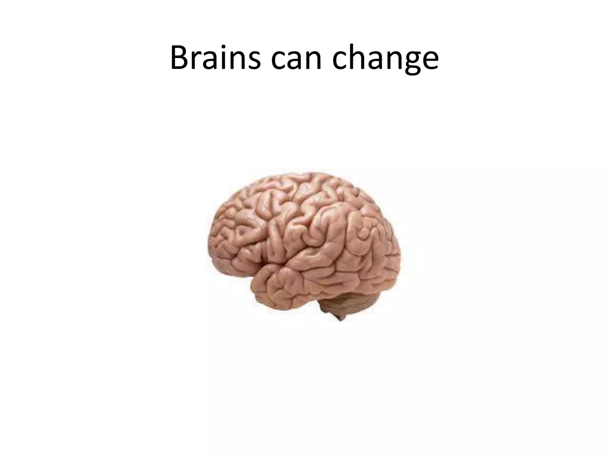 Brains can change
 