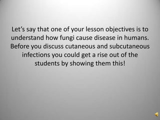 Let’s say that one of your lesson objectives is to understand how fungi cause disease in humans. Before you discuss cutaneous and subcutaneous infections you could get a rise out of the students by showing them this!