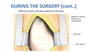 How to perform a Open Heart Surgery | PPTX