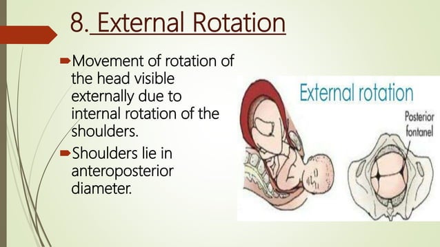 mechanism of labor | PPTX | Pregnancy | Reproductive Health