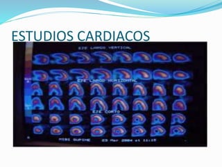 ESTUDIOS CARDIACOS