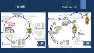 Teniasis Cisticercosis
 