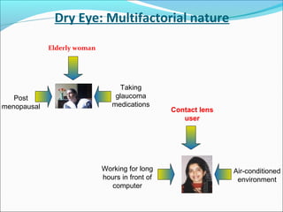 Dry Eye: Multifactorial nature
Elderly woman
Contact lens
user
Post
menopausal
Taking
glaucoma
medications
Working for long
hours in front of
computer
Air-conditioned
environment
 