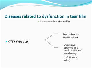 Diseases related to dysfunction in tear film
Lacrimation from
excess tearing
Obstructive
epiphoria as a
result of failure of
tear drainage
( Schirmer’s
value)
 