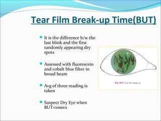 Tear Film Break-up Time(BUT)
It is the difference b/w the
last blink and the first
randomly appearing dry
spots
Assessed with fluorescein
and cobalt blue filter in
broad beam
Avg of three reading is
taken
Suspect Dry Eye when
BUT<10secs
 