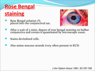 Rose Bengal
staining
 Rose Bengal solution 1%
placed into the conjunctival sac.
 After a wait of 2 mins, degree of rose bengal staining on bulbar
conjunctiva and cornea is quantitated by microscopic exam.
 Stains devitalized cells.
 Also stains mucous strands (very often present in KCS)
J Am Optom Assoc 1991, 62:187-199
 