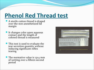 Phenol Red Thread test
A sterile cotton thread is draped
over the non-anesthetized lid
margin
It changes color upon aqueous
contact and the length of
colored thread is measured
This test is used to evaluate the
tear secretion quantity without
inducing significant reflex
tearing
The normative value is 13±4 mm
of wetting over a fifteen second
period
 