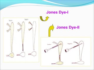 Jones Dye-I
Jones Dye-II
 