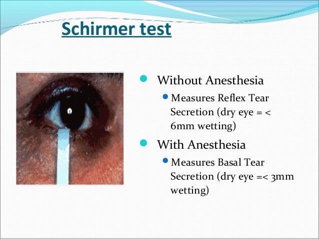 tear film schirmer test