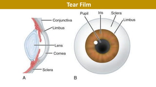 Tear Film
 