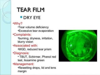Tearfilm by arya