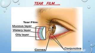 TEAR FILM…..
 