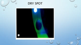 DRY SPOT
 