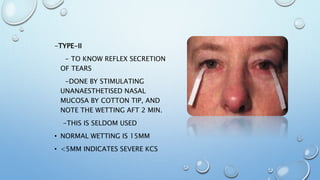 -TYPE-II
- TO KNOW REFLEX SECRETION
OF TEARS
-DONE BY STIMULATING
UNANAESTHETISED NASAL
MUCOSA BY COTTON TIP, AND
NOTE THE WETTING AFT 2 MIN.
-THIS IS SELDOM USED
• NORMAL WETTING IS 15MM
• <5MM INDICATES SEVERE KCS
 