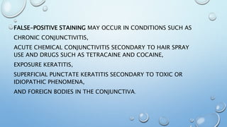 FALSE-POSITIVE STAINING MAY OCCUR IN CONDITIONS SUCH AS
CHRONIC CONJUNCTIVITIS,
ACUTE CHEMICAL CONJUNCTIVITIS SECONDARY TO HAIR SPRAY
USE AND DRUGS SUCH AS TETRACAINE AND COCAINE,
EXPOSURE KERATITIS,
SUPERFICIAL PUNCTATE KERATITIS SECONDARY TO TOXIC OR
IDIOPATHIC PHENOMENA,
AND FOREIGN BODIES IN THE CONJUNCTIVA.
 