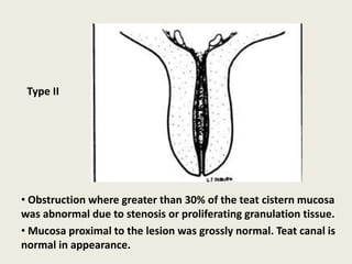 • Obstruction where greater than 30% of the teat cistern mucosa
was abnormal due to stenosis or proliferating granulation tissue.
• Mucosa proximal to the lesion was grossly normal. Teat canal is
normal in appearance.
Type II
 