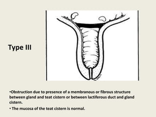 •Obstruction due to presence of a membranous or fibrous structure
between gland and teat cistern or between lactiferous duct and gland
cistern.
• The mucosa of the teat cistern is normal.
Type III
 